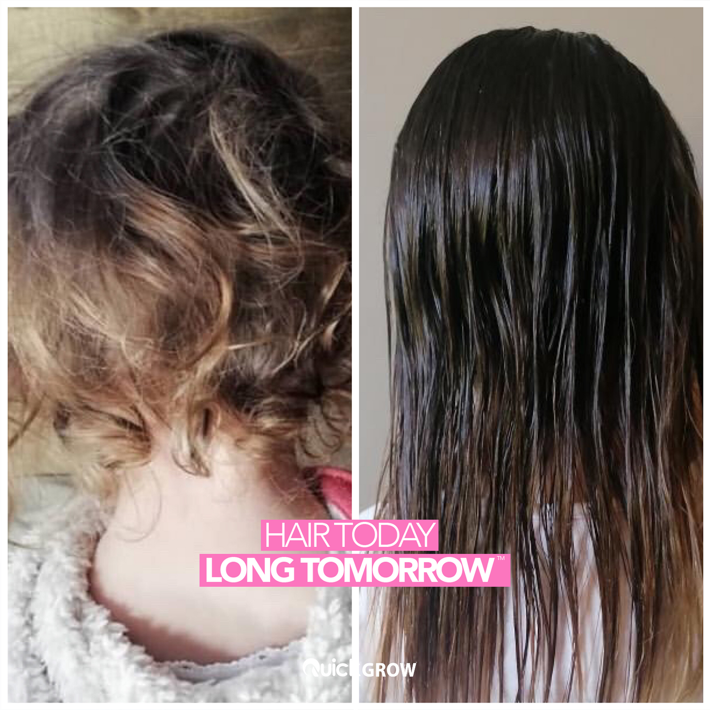 Quick Grow Before After